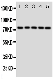 1 - Anti-Grp75 Antibody ABO11097
