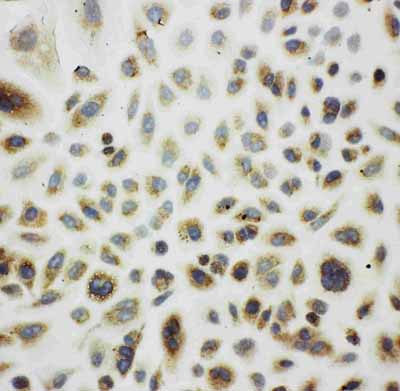 8 - Anti-Cpn10 Antibody ABO11098