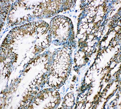 2 - Anti-Cpn10 Antibody ABO11098