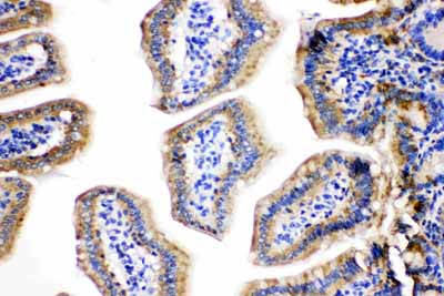 2 - Anti-Cpn10 Antibody ABO11098