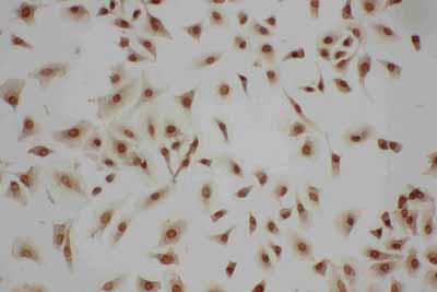 8 - Anti-LASP1 Antibody ABO11099