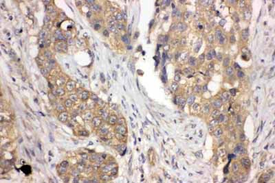 2 - Anti-LASP1 Antibody ABO11099