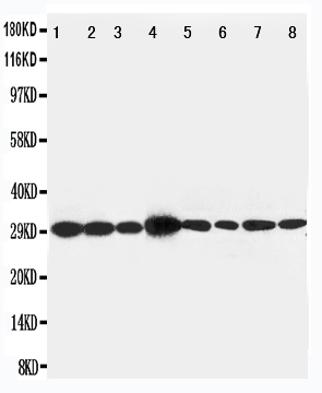 1 - Anti-LASP1 Antibody ABO11099