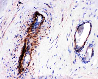 2 - Anti-LASP1 Antibody ABO11100