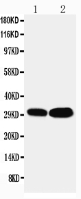 1 - Anti-LASP1 Antibody ABO11100