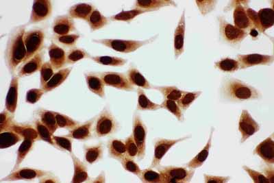 8 - Anti-MCM7 Antibody ABO11101