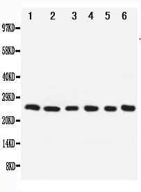 1 - Anti-Apoptosis Repressor With CARD Antibody ABO11102