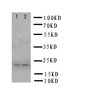 1 - Anti-PRNP Antibody ABO11103