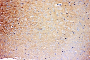 2 - Anti-PRNP Antibody ABO11104