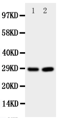 1 - Anti-PRNP Antibody ABO11104
