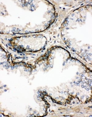 2 - Anti-SSR3 Antibody ABO11105