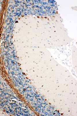 2 - Anti-SSR3 Antibody ABO11105