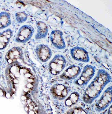 2 - Anti-SSR3 Antibody ABO11105