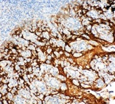 2 - Anti-14-3-3 Sigma Antibody ABO11106