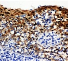 2 - Anti-14-3-3 Sigma Antibody ABO11106