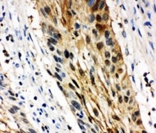 2 - Anti-14-3-3 Sigma Antibody ABO11106