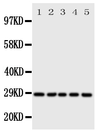 1 - Anti-14-3-3 Sigma Antibody ABO11106