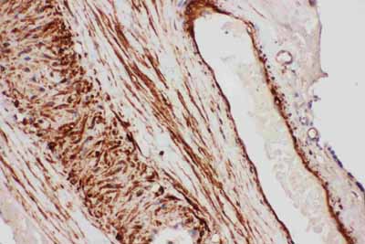 2 - Anti-TFPI Antibody ABO11107