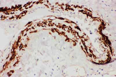 2 - Anti-TFPI Antibody ABO11107