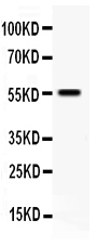 1 - Anti-TFPI Antibody ABO11107