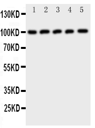 1 - Anti-CBL Antibody ABO11108