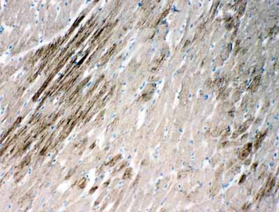 2 - Anti-HSPB2 Antibody ABO11110