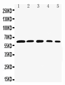 1 - Anti-Rel B Antibody ABO11111