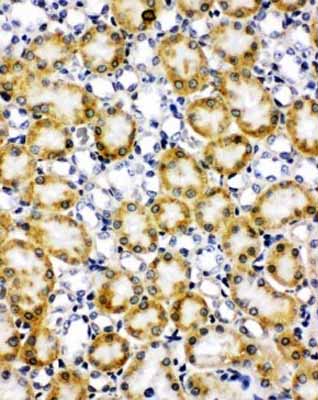 2 - Anti-Paxillin Antibody ABO11112