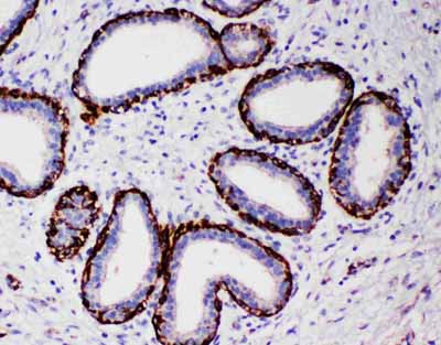 2 - Anti-Arg2 Antibody ABO11113