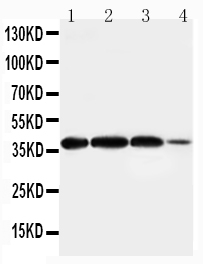 1 - Anti-Arg2 Antibody ABO11113