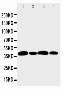 1 - Anti-Aurora B Antibody ABO11114