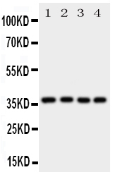 1 - Anti-Bmi1 Antibody ABO11115