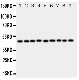 1 - Anti-E2F2 Antibody ABO11118