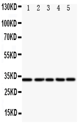1 - Anti-E2F6 Antibody ABO11119