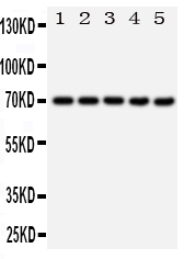 1 - Anti-Hsp70 Antibody ABO11121