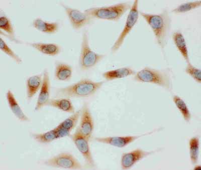 8 - Anti-GRP78 BiP Antibody ABO11123