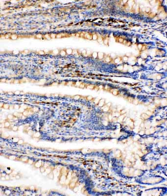 2 - Anti-GRP78 BiP Antibody ABO11123