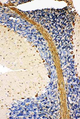 2 - Anti-GRP78 BiP Antibody ABO11123
