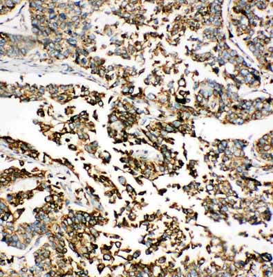 2 - Anti-GRP78 BiP Antibody ABO11123