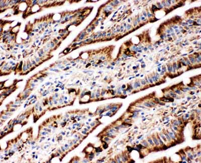 2 - Anti-GRP78 BiP Antibody ABO11123