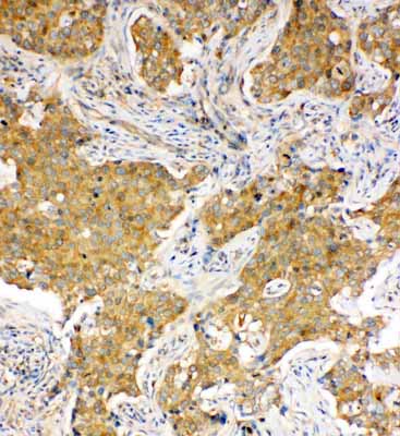 2 - Anti-Hsc70 Antibody ABO11124