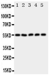 1 - Anti-HYAL2 Antibody ABO11125