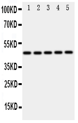1 - Anti-IRF3 Antibody ABO11127