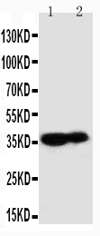 1 - Anti-Kallikrein 9 Antibody ABO11128