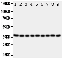 1 - Anti-Kallikrein 10 Antibody ABO11129