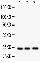 1 - Anti-MPG Antibody ABO11133