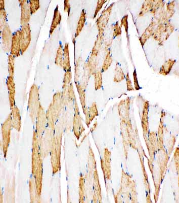2 - Anti-Myoglobin Antibody ABO11135