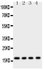 1 - Anti-Myoglobin Antibody ABO11135