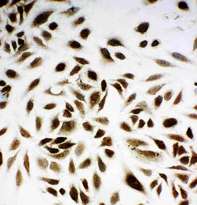 8 - Anti-NM23A Antibody ABO11137