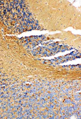 2 - Anti-NM23A Antibody ABO11137